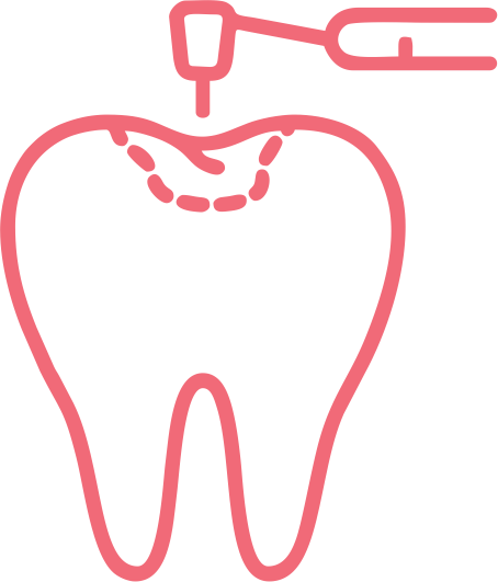 Dental Restorations /Filling