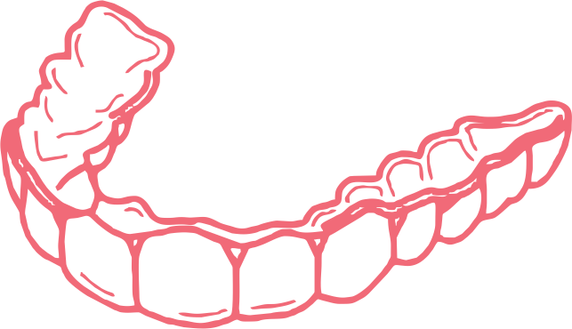 Aligner treatment