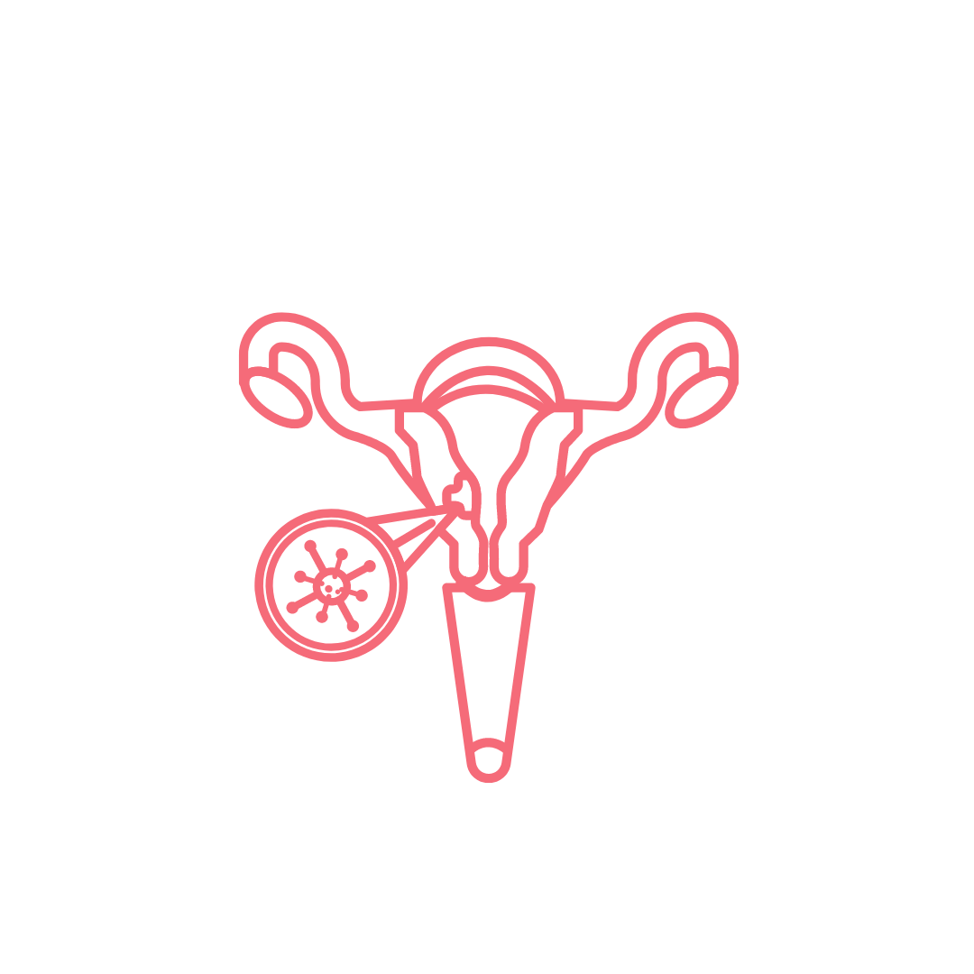 Uterine fibroids